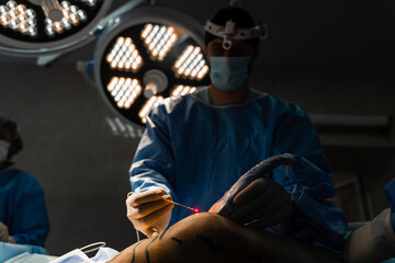 Vascular surgeon is operating leg using EVLT Red laser optical fiber for endovenous laser...