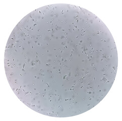 Photomicrograph of Semen analysis show normal count of sperm depend on quantity and morphology.
