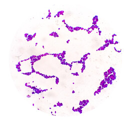 Candida Spp colony under microscopic view. Candida albicans. Fungal infection.