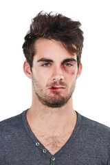 Obraz premium Portrait, injury and man with black eye in studio for bruise, blood and conflict in white background. Face, wound and male after domestic abuse attack, crisis and danger while standing isolated