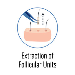 Fototapeta premium Alopecia Grafts Extraction Composition