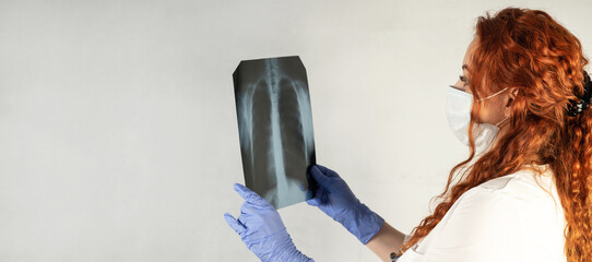 Radiography. A doctor examines a chest x-ray of a patient in a hospital. Lung radiography concept....