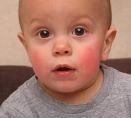 Small boy with pink cheeks