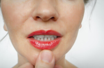 White teeth of a woman. Dentistry. Treatment.