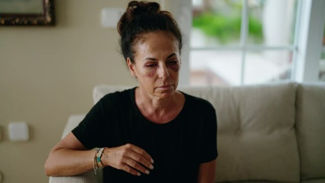 Middle age hispanic woman suffering for domestic violence with bruise on eyes at home