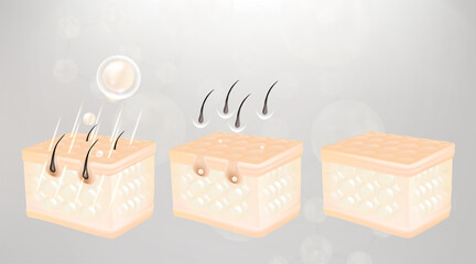 Hair removal before and after hair and skin solutions ad, white removing serum drop over skin cells with cosmetic advertising background ready to use, illustration vector.