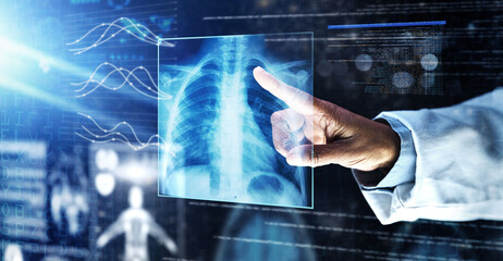 Doctor, healthcare or finger on xray hologram in tuberculosis virus, cancer analytics or asthma x ray at night. Futuristic, abstract or medical lungs scan for surgery planning or hospital woman help - obrazy, fototapety, plakaty