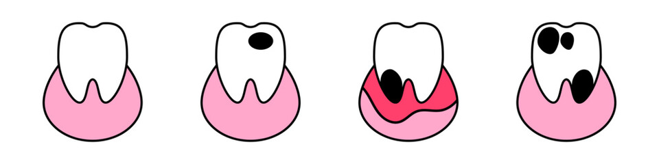 Tooth icons set. Dentist teeth. Inflammation of the gums. Tooth crumbling. Hole in the tooth. Caries. Vector illustration isolated on white background.