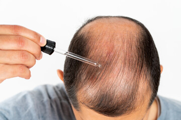 Young man hair treatment. Argan oil healthy massage.Close up of male person who applies a product...