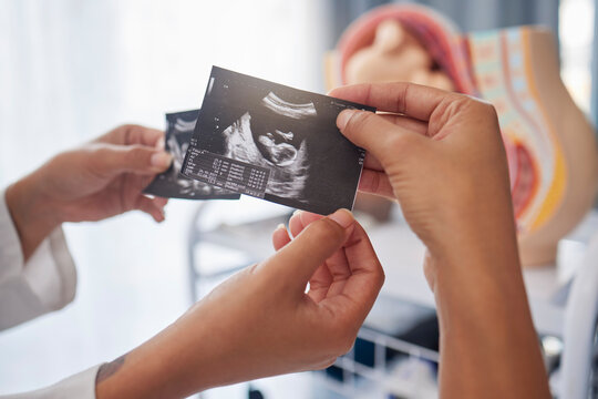 Sonogram, showing and hands with an ultrasound of a baby from the doctor to mother at a clinic. Consultation, pregnancy and pregnant woman with a picture of a child from a gynecologist at hospital