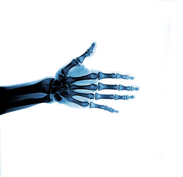X-ray view hand on white background