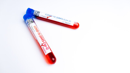 flasks with blood tests for monkey pox virus positive and negative, mpox