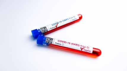 flasks with blood tests for monkey pox virus positive and negative, mpox