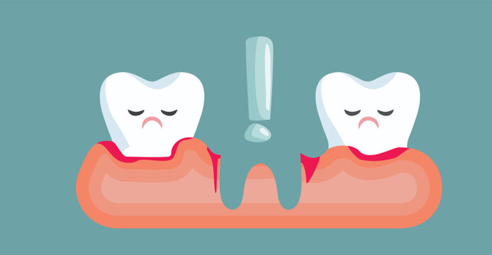 Tooth Loss in Oral Health Concept Medical Cartoon Illustration. Teeth missing due to bad hygiene and gum disease 

