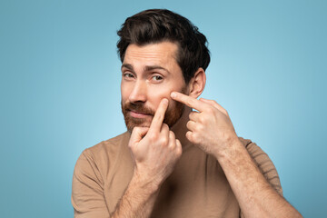 Portrait of bearded man touching his face, pressing pimple on face with fingers, looking at camera, blue background