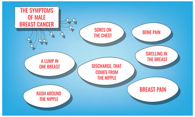 the symptoms of Male breast cancer. Vector illustration for medical journal or brochure.