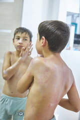 Fototapeta na wymiar Skin itching, dermatitis, food allergy on the face. A boy with red spots. The child has itching, on the face with an allergic rash.