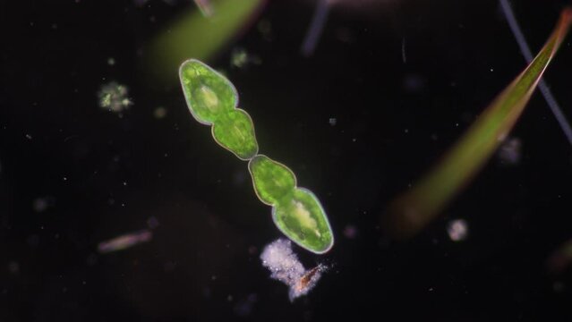 Algae and Protist in waste water under the microscope.