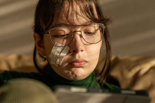 a girl has a catheter sticking out of her nose after a puncture of the maxillary sinus.