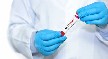 Doctor holding a test blood sample tube positive with ?ovid-19 XBB.1.5 Kraken Variant variant or...