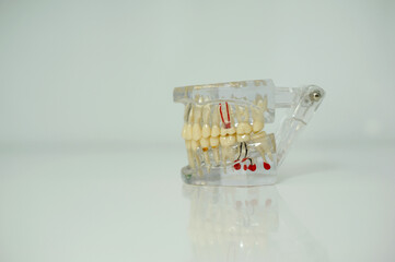 jaw model to demonstrate all dental diseases plastic teeth woman hand opens closes skull jaws white background stomatology gum channels place for text dental office dental treatment technology
