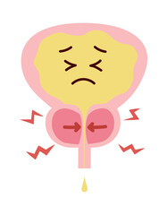 前立腺肥大で苦しそうな膀胱のイラスト