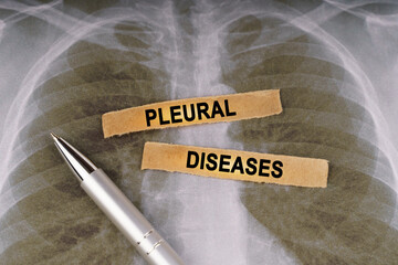 On a human chest x-ray, a pen and strips of paper labeled - PLEURAL DISEASES