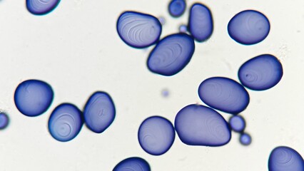 Starch granules of potato. Stained by lugol iodine. 400x magnification with selective focus
