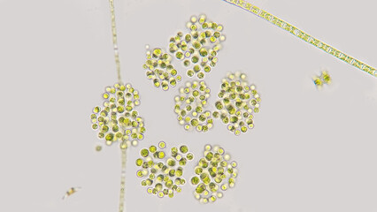 Dictyosphaerium sp, a freshwater colonial microalgae. Selective focus