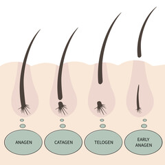 Illustration with type of eyelashes. Phases of growth. Hair growth cycle. Anagen, catagen, telogen, early anagen. 
Speech bubble with text.