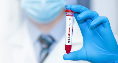 Doctor holding a test blood sample tube positive with ?ovid-19 XBB.1.5 Kraken Variant variant or strain COVID-19.