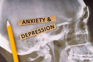 On x-rays of a human skull, a pencil and strips of paper with the inscription - Anxiety and...