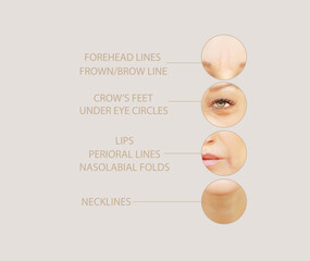 Effects of ageing,Frownscowl lines ,Nasolabial folds,Neck ,Under eye circles,neck lines. Plastic...