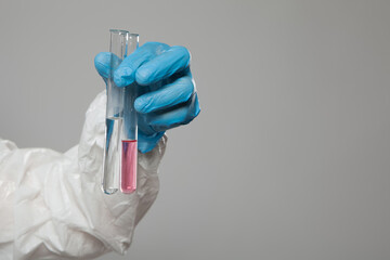 Laboratory worker holding test tubes with substance samples for analysis on gray background....