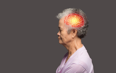 Dementia in senior people. Alzheimer's disease, Parkinson's disease, stroke, or mental health