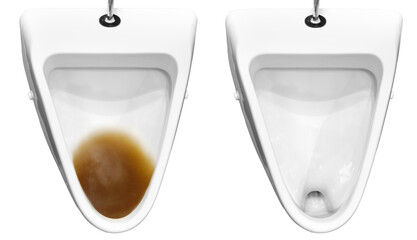 Dirty toilet before and after removing the blockage, isolated on a white background. Clog problems...
