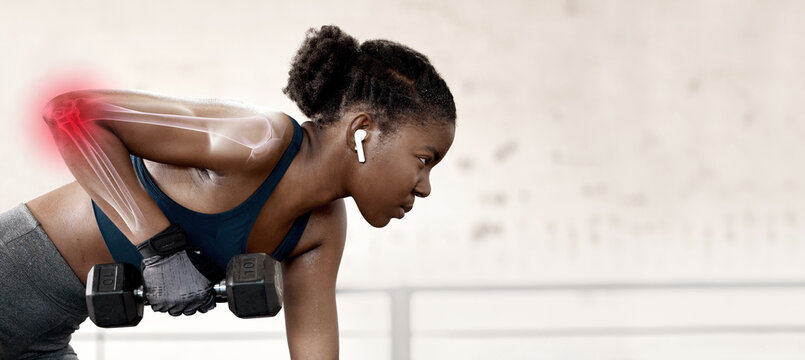 Bone Overlay, Dumbbell And Black Woman Doing Weight Training With Mockup Outdoor With Joint Pain. Arm Joints Inflammation, Athlete Exercise And Sports Workout Of A Female With Music And Mock Up