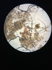 Notoedres cati under the microscope. Notoedric mange, also referred to as Feline scabies.