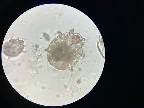 Notoedres cati under the microscope. Notoedric mange, also referred to as Feline scabies.