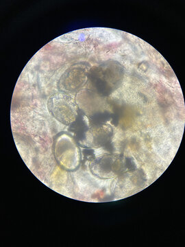 Scabies, Notoedres egg under the Microscope.