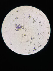 Microscopic view of struvite crystals from urinary sediment. Magnesium ammonium phospate crystals. Causing Feline Lower Urinary Tract Disease