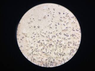 Microscopic view of struvite crystals from urinary sediment. Magnesium ammonium phospate crystals. Causing Feline Lower Urinary Tract Disease