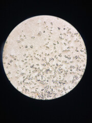 Microscopic view of struvite crystals from urinary sediment. Magnesium ammonium phospate crystals. Causing Feline Lower Urinary Tract Disease