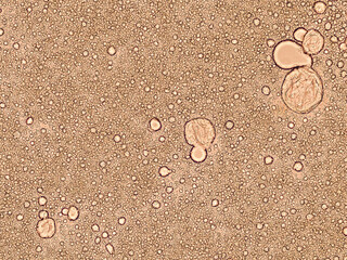 breast milk under the microscope - optical microscope x200 magnification