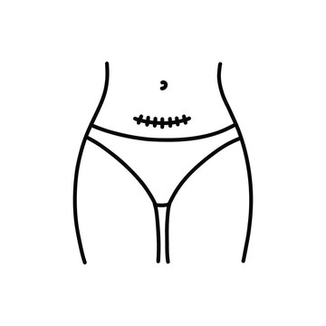 Caesarean section doodle icon, vector color line illustration