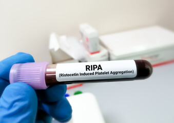 Ristocetin-induced platelet aggregation (RIPA) test, used to determine the presence and integrity of the platelet glycoprotein (GP) Ibα-V-IX complex and von Willebrand factor (VWF) interaction.