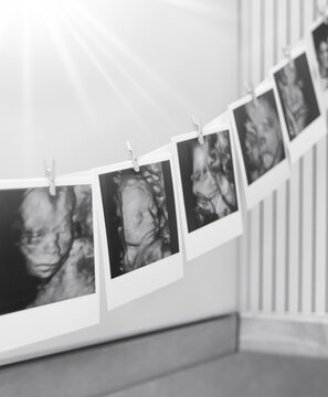 Collage of black and white photos story of ultrasound pictures of baby. Family, Childbirth, New Life concept background