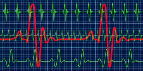 Cardiogram charts pattern