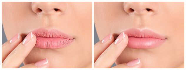 Collage with photos of woman before and after using lip balm on grey background, closeup