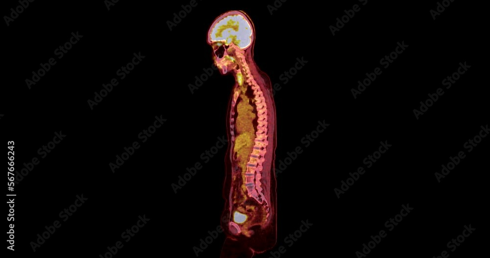 Poster pet ct scan ( positron emission tomography ) of whole human body 3d rendering image red color tone a